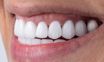 Cosmetic Dentistry in Delhi