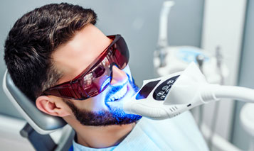 Teeth Whitening in Delhi