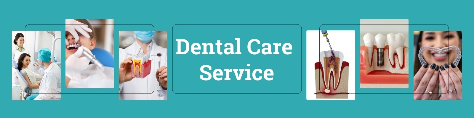 Types of Dental Implants