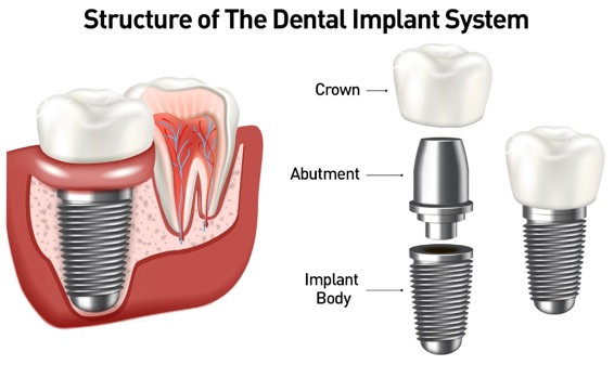 dentist in badarpur.